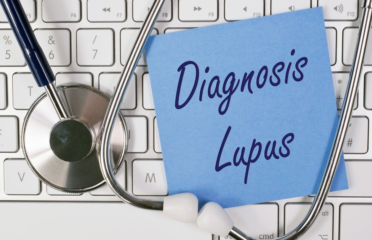 Lupus