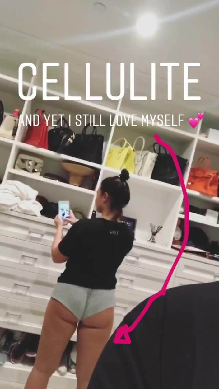 Demi Lovato, celulit